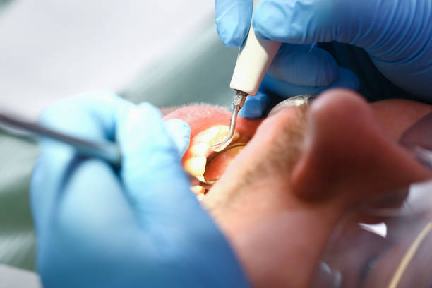 Best Urgent Tooth Repair  in St Gabriel, LA