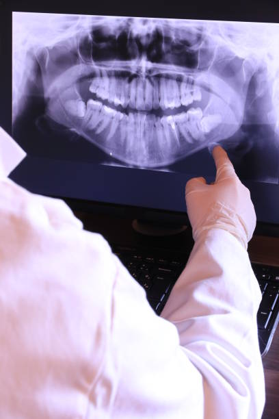 Best Root Canal Emergency Dentist  in St Gabriel, LA